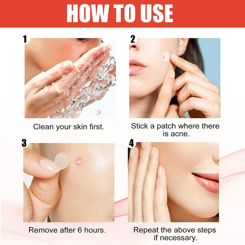 Invisible Hydrocolloid Acne Patch Self-Repair Patch Absorbing Covering Pads for Covering Pimples and Blemishes