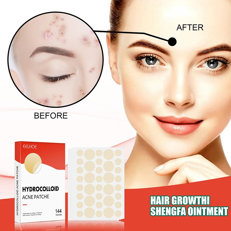 Invisible Hydrocolloid Acne Patch Self-Repair Patch Absorbing Covering Pads for Covering Pimples and Blemishes